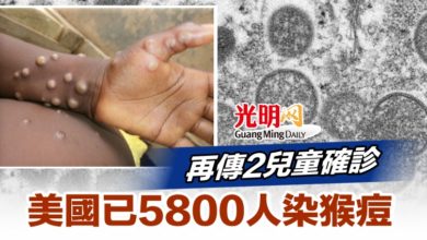 Photo of 再傳2兒童確診 美國已5800人染猴痘