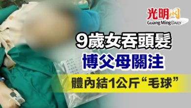 Photo of 9歲女吞頭髮博父母關注 體內結1公斤“毛球”