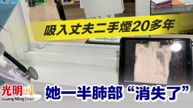 Photo of 吸入丈夫二手煙20多年 她一半肺部“消失了”