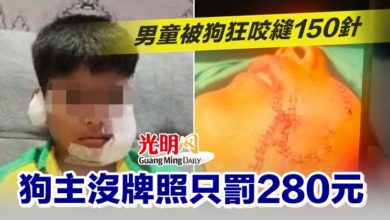 Photo of 男童被狗狂咬縫150​​針 狗主沒牌照只罰280元