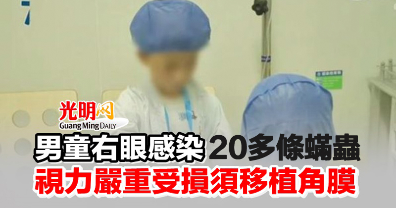 男童右眼感染20多條蟎蟲 視力嚴重受損須移植角膜 | 国际 | 2022-11-15 – 光明日报