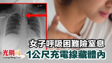 Photo of 女子呼吸困難險窒息 1公尺充電線藏體內