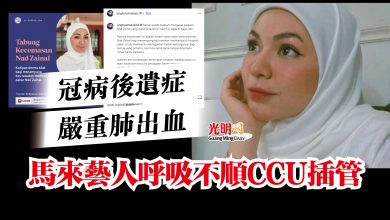 Photo of 冠病後遺症嚴重肺出血  馬來藝人呼吸不順CCU插管