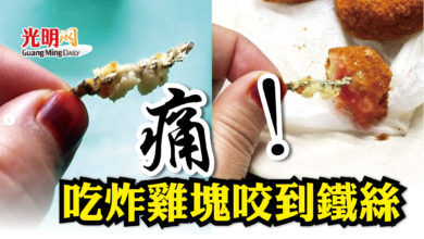 Photo of 痛！吃炸雞塊咬到鐵絲
