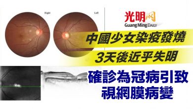 Photo of 中國少女染疫發燒3天後近乎失明 確診為冠病引致視網膜病變