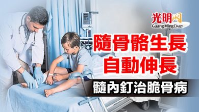 Photo of 【本地醫療】隨骨骼生長自動伸長 髓內釘治脆骨病
