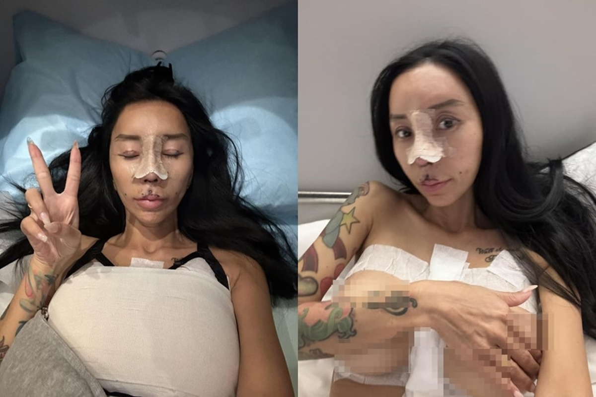 Leng Yein此次共進行鼻子重新塑型、 胸部縮小、臀部縮小