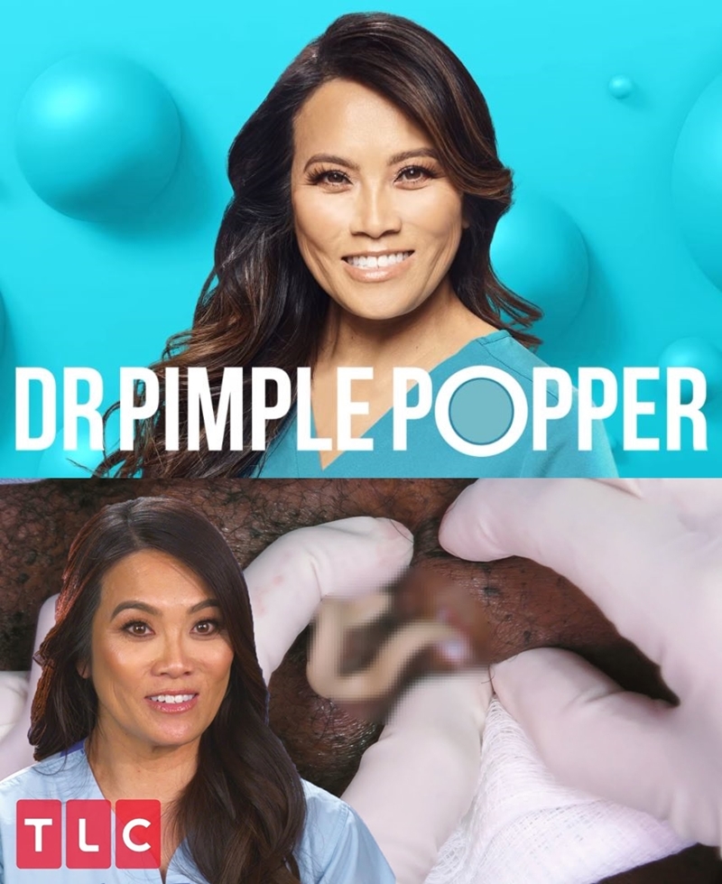 “ Dr. Pimple Popper ”（戰痘醫師）的主持人兼皮膚科醫生桑德拉‧李