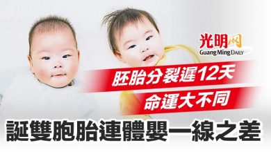 Photo of 【本地醫療】胚胎分裂遲12天命運大不同  誕雙胞胎連體嬰一線之差