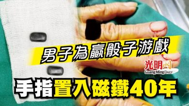 Photo of 男子為贏骰子游戲 手指置入磁鐵40年