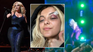 Photo of 美國女歌手表演 遭觀衆砸中臉縫針