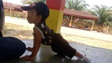 Photo of 2歲童天生無髖骨患腎病 母心痛：他拖著腳也要走