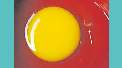 Photo of 疑天氣熱導致 雞蛋白有寄生蟲