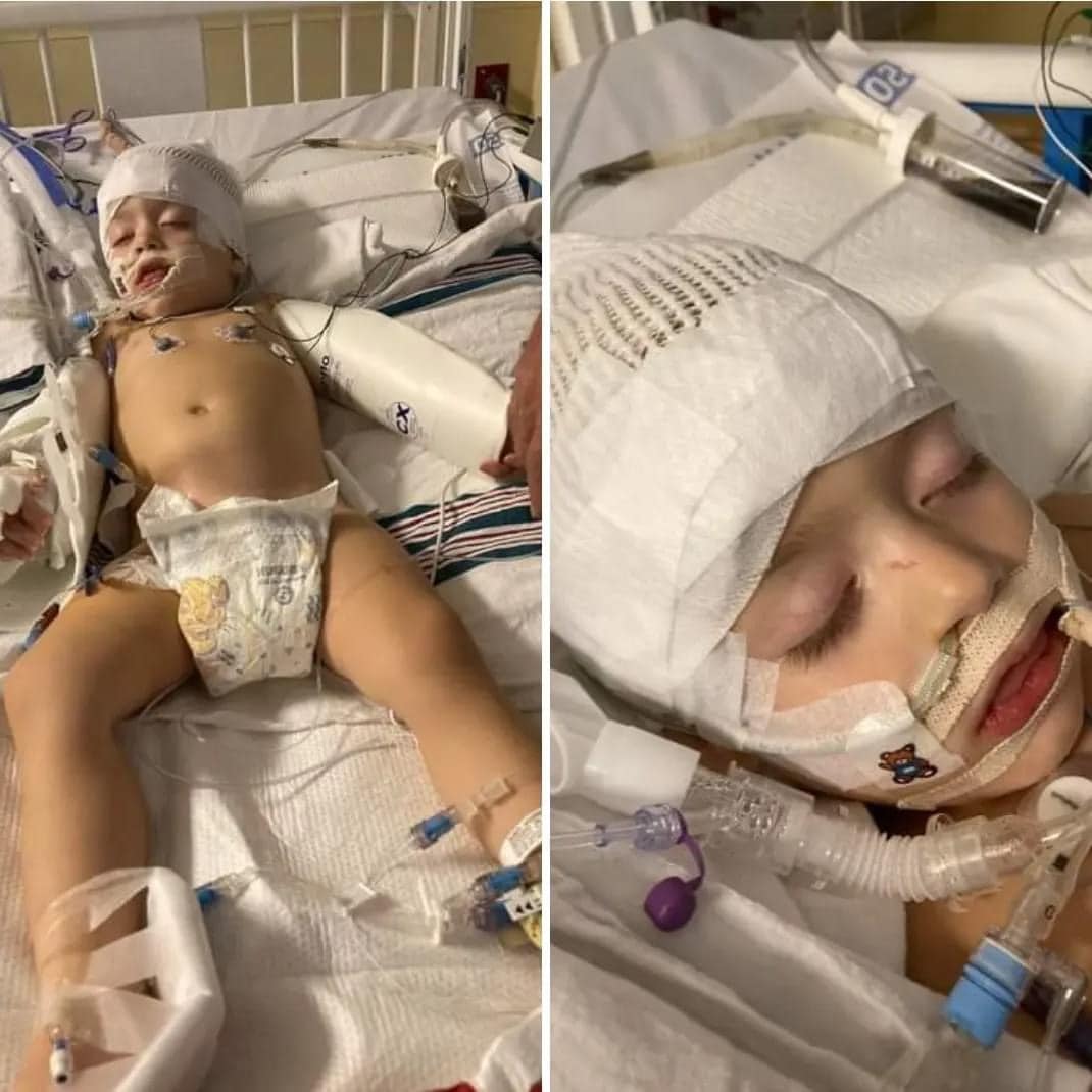 2歲童泡溫泉感染食腦變形蟲“他戰鬥了7天不治” | 精选| 即时| 国际| 2023-07-22 – 光明日报