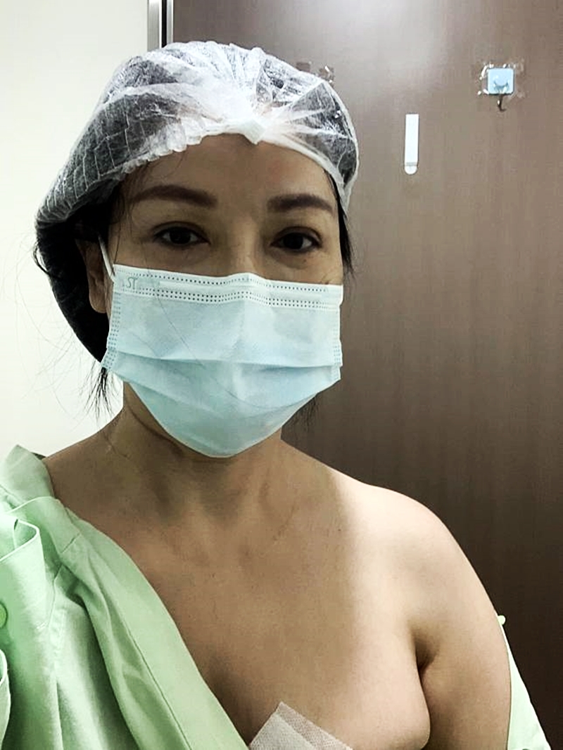 王小芬去年才動刀摘乳房腫瘤。