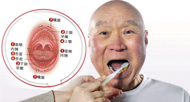 [Wan Qingyi Care]Foreign objects strayed into the trachea and the elderly with high bacterial content Oral hygiene to prevent aspiration pneumonia