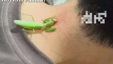 Photo of 中國男子頸後長病毒疣 竟靠「螳螂」治療