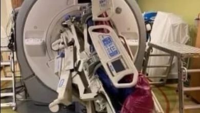 Photo of 醫院MRI機器突吸入病床  護士被夾中間螺絲插入體