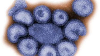 Photo of 英國發現首例人類感染甲型H1N2流感病例