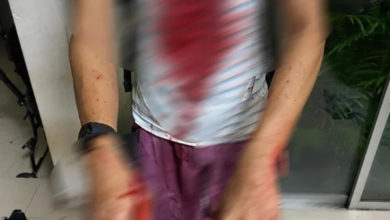 Photo of 6am跑步被搶劫  男子全身是血