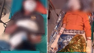 Photo of 手機放床頭充電 爆炸引燃棉被 夫妻被嚴重燒傷