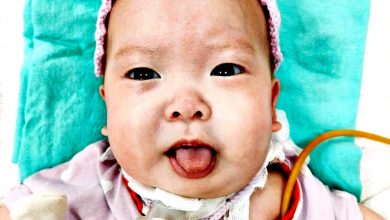Photo of 患喉軟化症 神經系統障礙 1歲女童須6萬治療