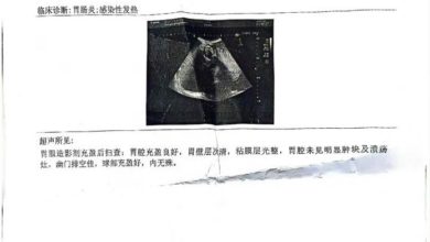 Photo of 中國女童發熱輸液後死亡 診治醫生遭停職