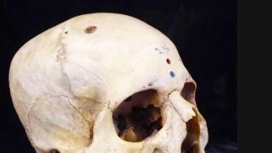 Photo of 古埃及醫學多先進？4000年前頭骨找到驚人“治癌”痕跡