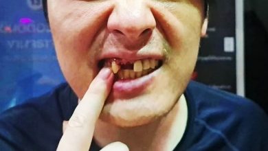 Photo of 疑付錢用丟的惹怒店家 韓男當場被打斷3顆牙
