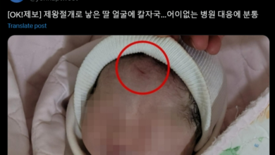 Photo of 剖腹割傷女嬰臉 醫生竟甩鍋謢士