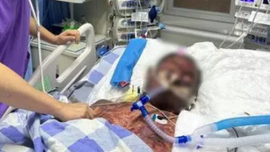 Photo of 帶傷切豬肉 感染豬鏈球菌 男子全身瘀青險喪命