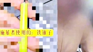 Photo of 女生大腿遭同桌男生扎218針 校方竟稱“不符合霸凌標準”