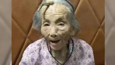 Photo of 107歲老人額頭長角 網驚呼“是長壽角”