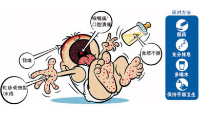 Photo of 傳染力強5歲以下高危 手足口症可致腦炎奪命