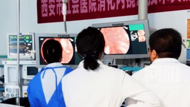 Photo of 陕西女子连吃6年胶袋 胃里取出1公斤塑料