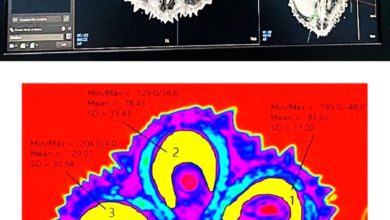 Photo of AI结合CT-Scan 榴梿扫描仪精准揪虫