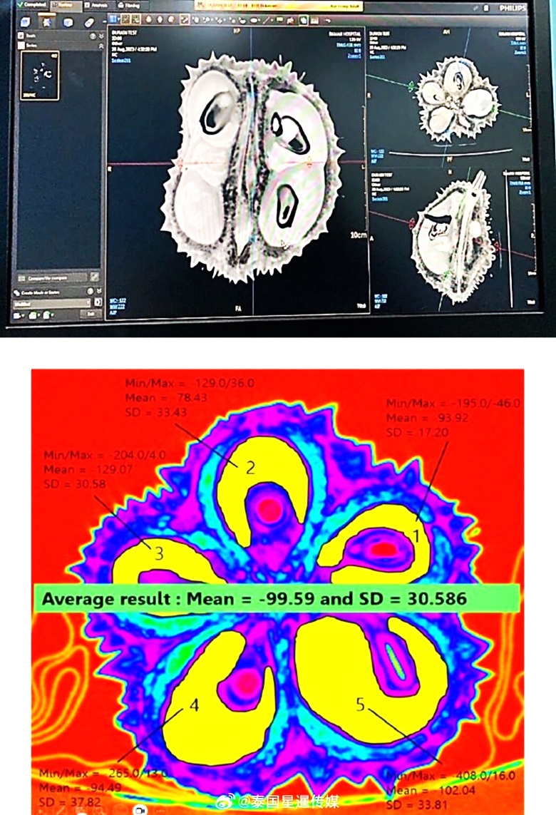 AI结合CT-Scan 榴梿扫描仪精准揪虫| 即时| 国际| 2025-03-22 – 光明日报