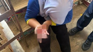 Photo of 手被铁栏刺伤 小学生上TikTok引起教育局关注