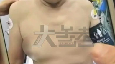 Photo of 大叔日吃一公斤瓜子 “罩杯升级”出门要束胸