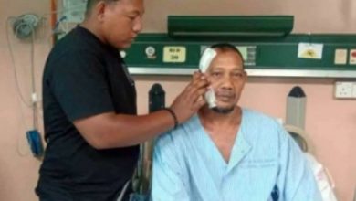 Photo of 工人遭铁条刺穿头 医生通宵手术救他