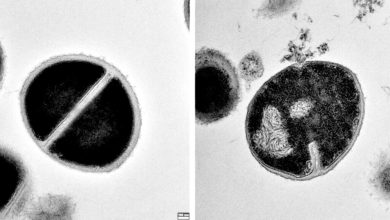 Photo of 人体“隐藏武器”曝光！科学家发现全新免疫机制 对抗超级细菌有解