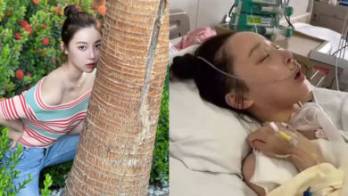 Photo of 28岁女星昏迷3个月奇迹苏醒 盼康复后能再拍戏
