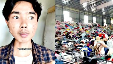 Photo of 穿未洗二手衣惹祸 男子染皮肤病爆红疹小疱