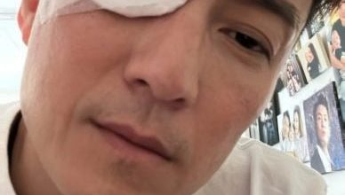 Photo of 陈山聪动手术眼贴纱布 网误以为“搞抽象”