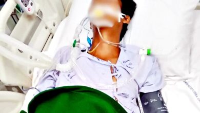 Photo of 医生误判蛇咬无毒 少年翌日昏迷命危