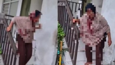 Photo of 老妇偷洋葱遭殴打 警: 她拒绝受援