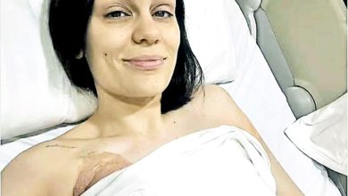 Photo of Jessie J 罹癌 緊急切乳房搶命