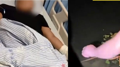 Photo of 好奇抓短尾蝮蛇被咬 男子手肿胀发黑急送医