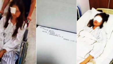 Photo of 在景区遭高压水枪射眼 女子右眼惨失明
