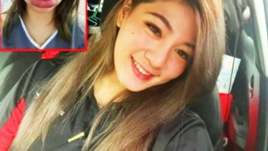 Photo of 美了还要更美 女子注射玻尿酸 唇肿如香肠